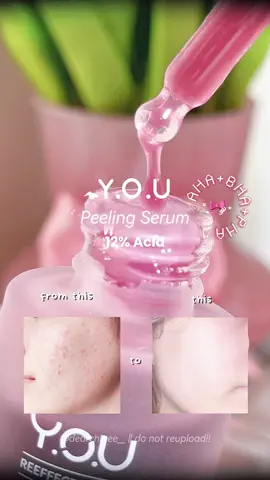 peeling serum gentle, ga bikin kulit cekat cekit 😍❤️ #you #youskincare #peelingserum #ahaskincare #peelingsolution #skincareviral #hebebeauty 