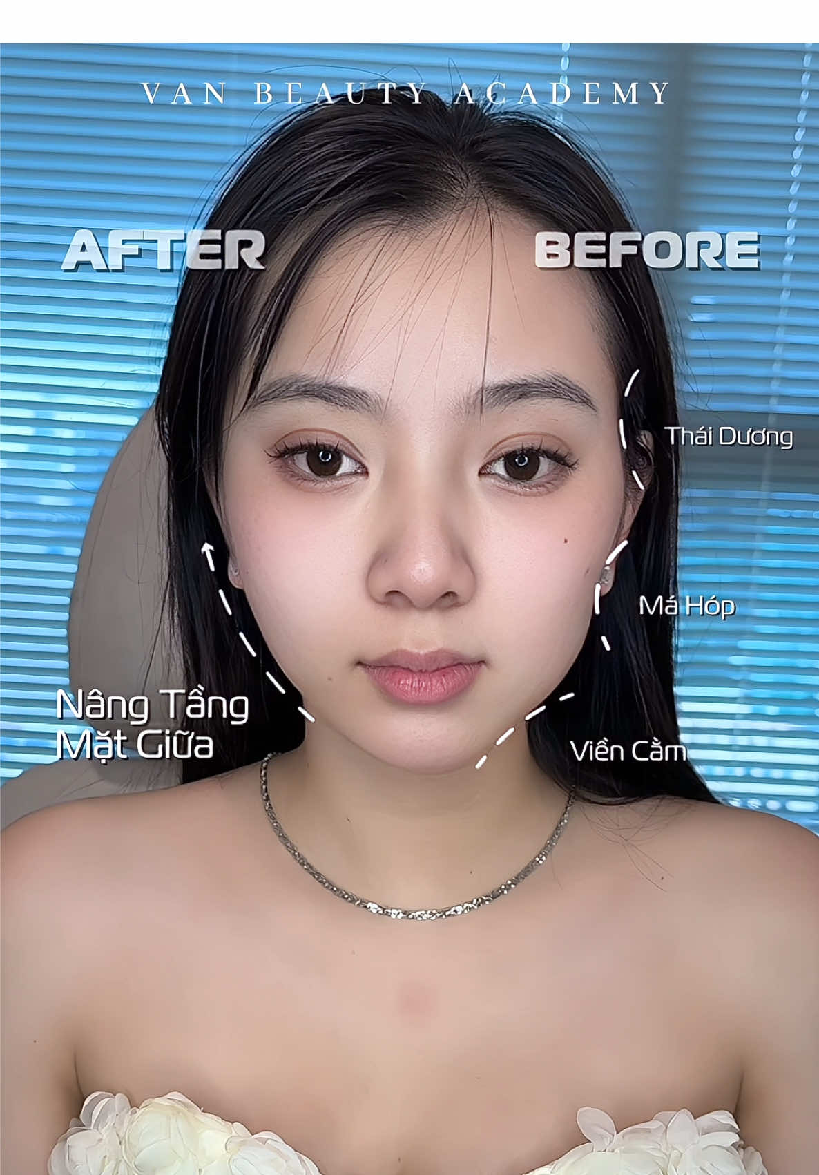 vi điểm nâng tầng mặt giữa 