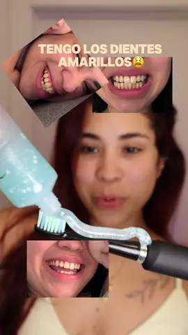 Toda mi vida me hicieron sentir mal por mis dientes… hasta que esto cambió todo.💔➡️💫 #dealsforyoudays #tiktokshopcreatorpicks #teethwhitening #teeth #teethcare 
