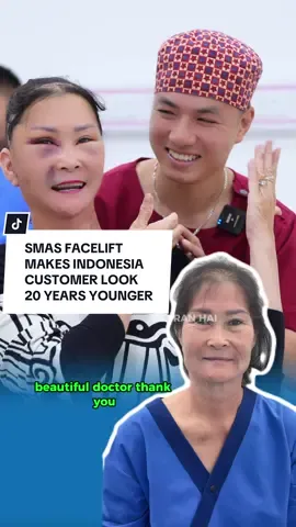 SMAS FACELIFT MAKES INDONESIA CUSTOMER LOOK 20 YEARS YOUNGER #facelift #facelifting #xuhuong #xuhuongtiktok #indonesia 