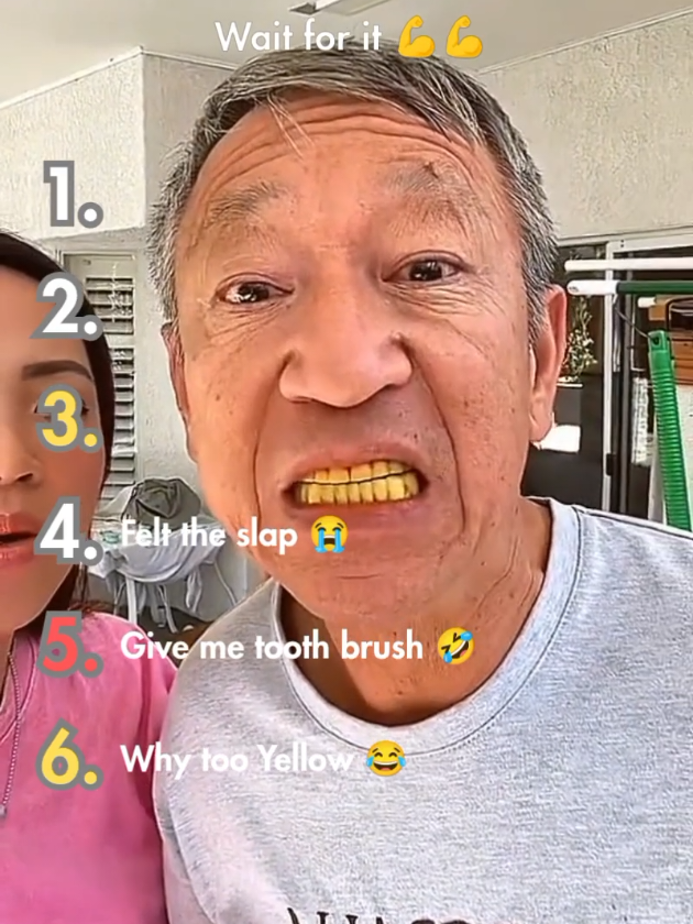 Teeth Filter Prank #filter #ranking #funnyvideo #relationships 
