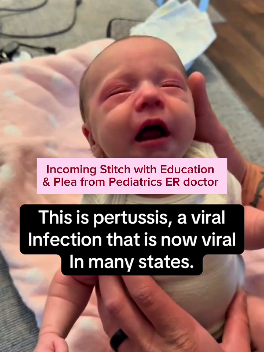 If older siblings are exposed or gwy whooping cough, they can be treated and younger ones can get prophylaxis  #vaccines #pertussis #pertussisawareness #whoopingcough 