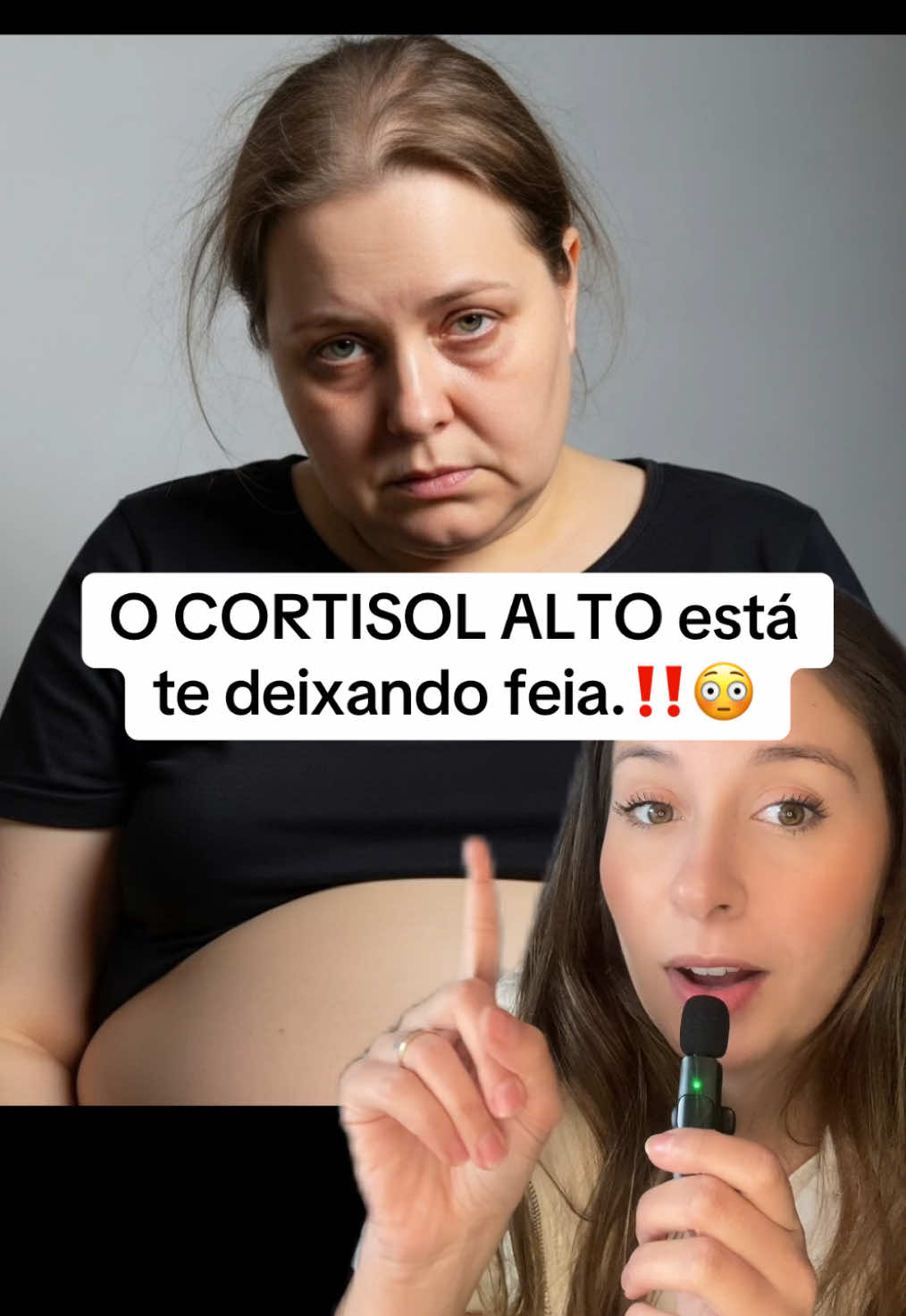 Cansado(a) de estresse, ansiedade e dificuldade para relaxar? Você não precisa mais conviver com isso! Descubra o Magnésio da BodyAction! ✨ Ele é a dose de tranquilidade e equilíbrio que seu corpo precisa, agindo de dentro para fora. Prático e essencial para sua rotina de saúde mental e física! 👉 Clique no carrinho laranja e garanta já o seu Magnésio da BodyAction! Sua mente e seu corpo agradecem! 🛒💨 #magnesio #cortisol #cortisolalto #cortisolelevado #mulheres 