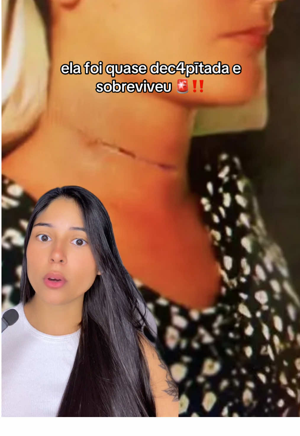 caso Alison Botha 😳 #casosreais #truecrime #truecrimetiktok #casocriminal 