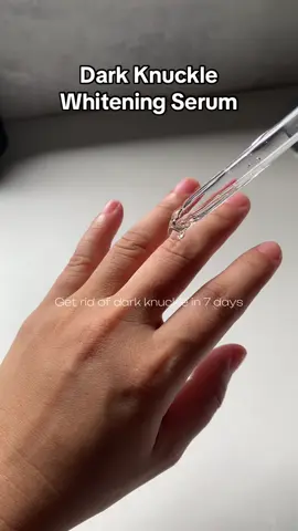 bago mapagod si Jo, Get rid of dark knuckle in 7 days #knuckleserum #darkknuckle #darkknucklesremover #serum #whiteningserum 
