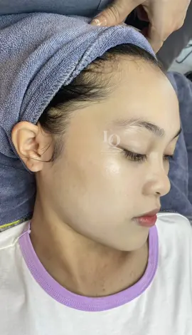 Cập nhật da Tàn Nhang#chamsocdamun#chamsocdanam#chamsocdaseo#Lequynhspa#Hocnghespa#nanmunbangtay#nanmunbangtambong
