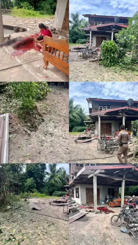 We Condemn Cambodia’s Attack on Civilian Targets within Thai Territory Early this morning (24 July 2025), the Cambodian Armed Forces opened fire into Thai territory, clearly violating international norms and endangering civilian lives. Following the attack, the Cambodian side attempted to distort the truth by spreading false information to the international community. Such actions are both unacceptable and shameful. #บูรณภาพเหนือดินแดนไทย #เพื่อความมั่นคงของชาติ #เฝ้าชายแดน #รักษาอธิปไตย #ประชาชน #กองทัพไทย #กองบัญชาการกองทัพไทย #กองทัพบก #กองทัพเรือ #กองทัพอากาศ #กองทัพภาคที่2 #Thailand #Cambodia #CambodiaviolatesOttawaConvention 