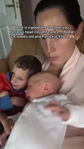 Patrick 9 and Aedan 4 weeks old 🫶🏻 #primordialdwarfism 