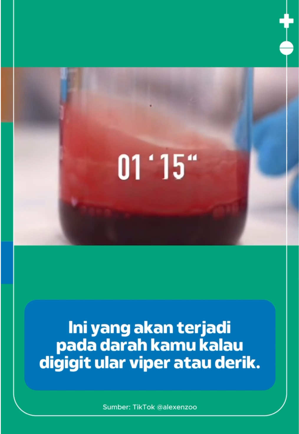 Waspada Racun Hemotoksin dari Gigitan Ular!  Racun hemotoksin menyerang sel darah merah dan sistem pembuluh darah. Efeknya bisa fatal: pembekuan darah abnormal, kerusakan jaringan, hingga kegagalan organ 😱 Jika tergigit, segera ke fasilitas medis! #KlikDokter #JagaSehatmu #Ular #Racun