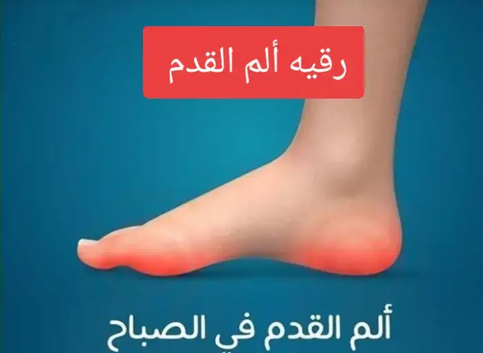 #الم #القدم #شفاء #