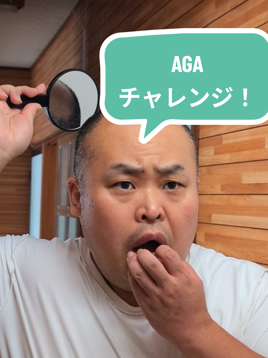 【一生ハゲは絶対イヤだ】 僕は結婚を目指す157cm／105kgの低身長デブ男。 ダイエットだけじゃ足りない。 今度は…髪と向き合うことにしました。 「坊主ならバレないでしょ」って逃げてたけど、 今は坊主でも…バレてるじゃん。 でも僕は、もう諦めません。 髪も人生も、取り戻す。 AGA治療、始めます。 治療の経過はストーリーズで公開していきます📱 --- #AGA治療 #薄毛対策 #自分磨き #ヘアケア男子 #pr 
