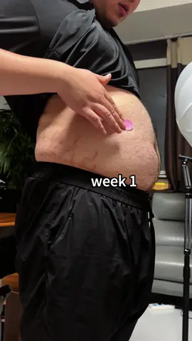 My progress with kind patches #dealsforyoudays #tiktokshopcreatorpicks 