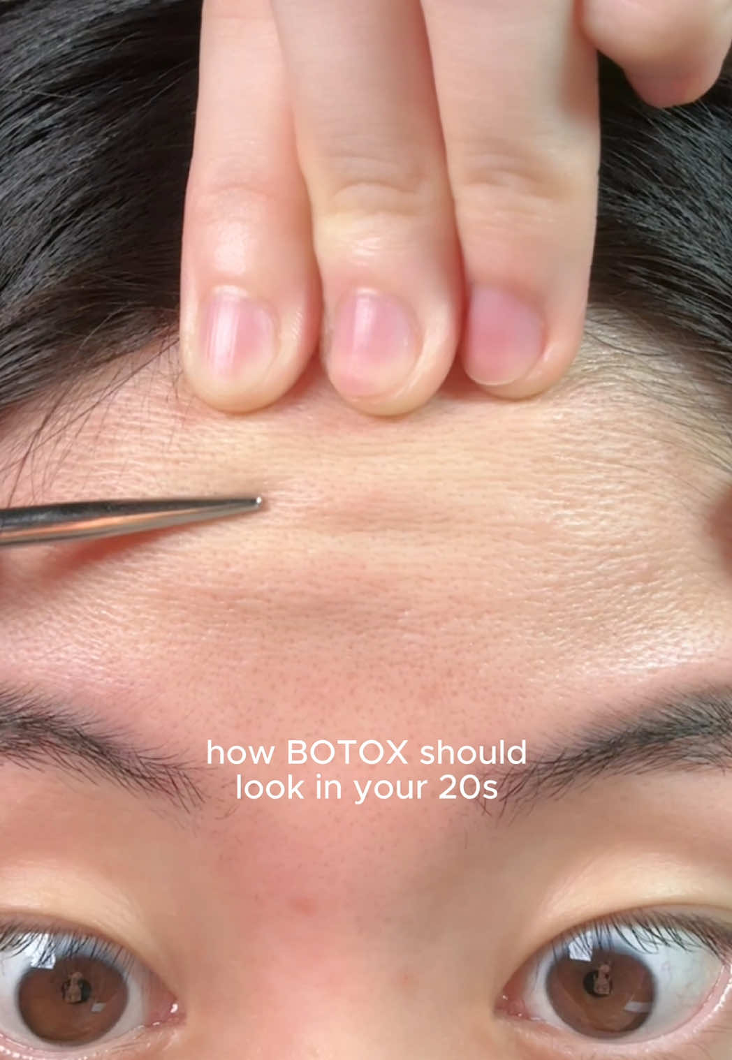Start with retinol, not Botox! ✅product used: @SKIN1004 US retinol 0.2 boosting shot ampoule #spiculeampoule #centella #skincare #pores #wrinkles #rerinol #labinnature 