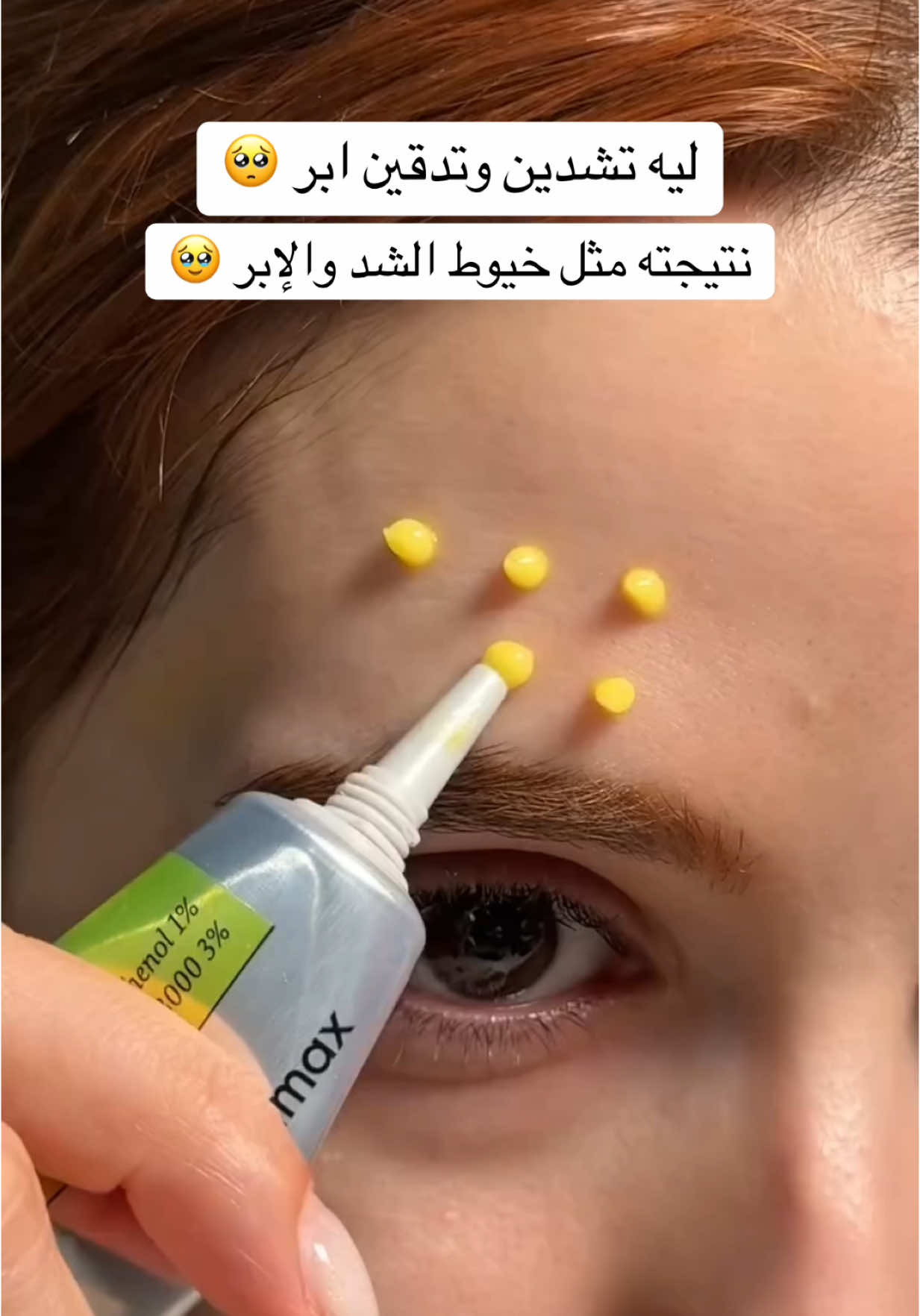 بديل البوتكسسسسسسس 👌🏼✨ #ريتينال #ريتينال_جيسينج_اسود #محاربة_علامات_الشيخوخة #fypシ #foryou #viral #explore 