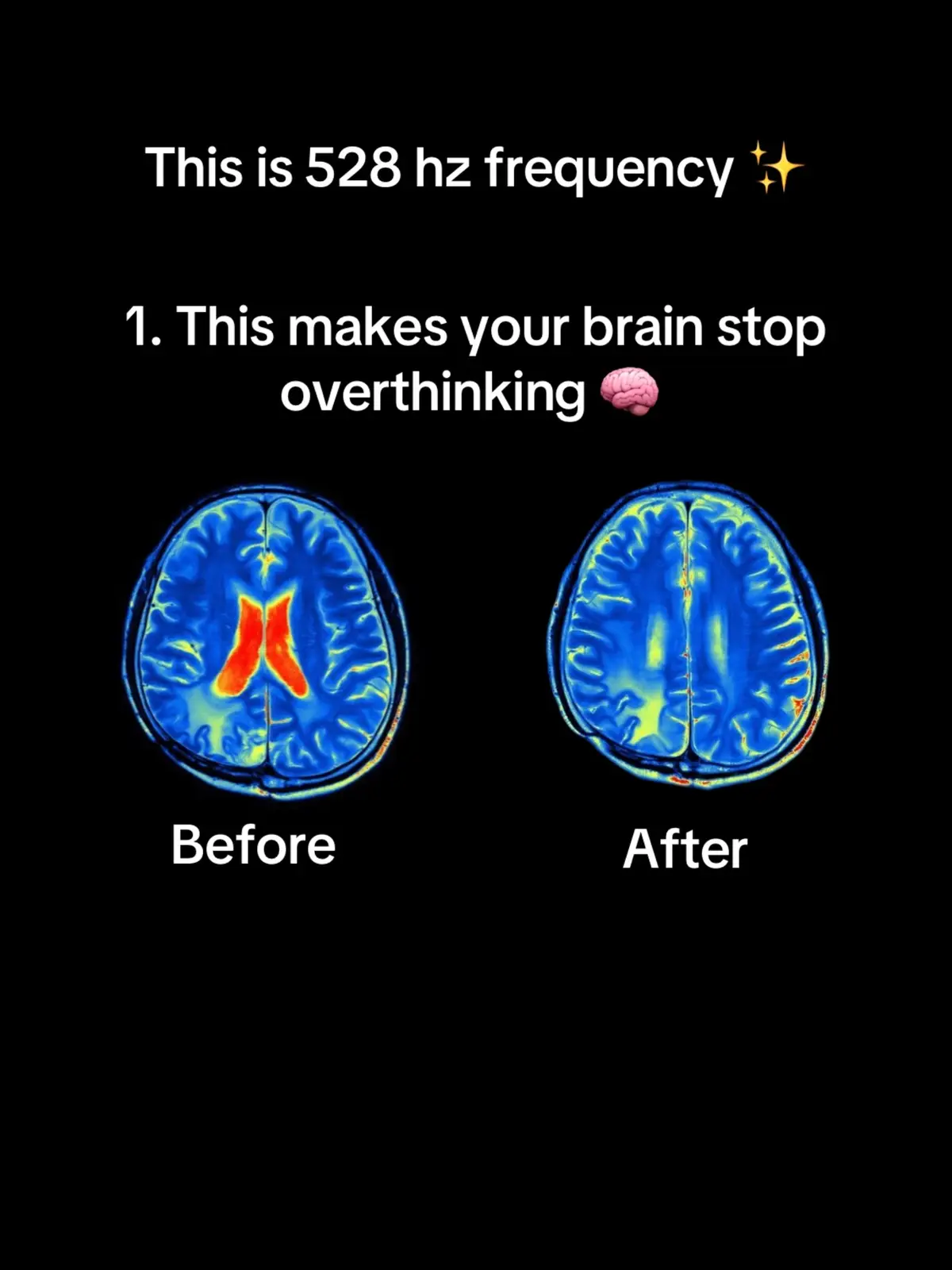 Listen to this 528 hz solfeggio frequency for 1 minute to stop overthinking 🧠 #meditation #528hz #healingtiktok #solfeggiofrequencies #spiritualtiktok 