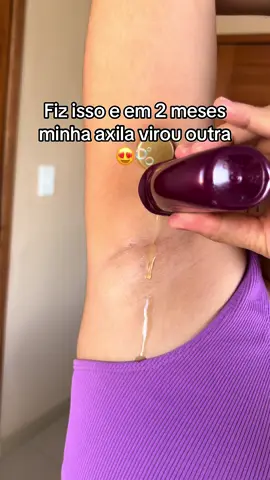 Dei adeus a axila manchada e clareei a virilha tb 😍 #dicasdebeleza #regeneradornf #axilasoscuras 