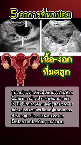#สุขภาพ #เซซามินbyจุ๋ม #ศูนย์จําหน่ายเซซามินเชียงใหม่ #เนื้องอกมดลูก 