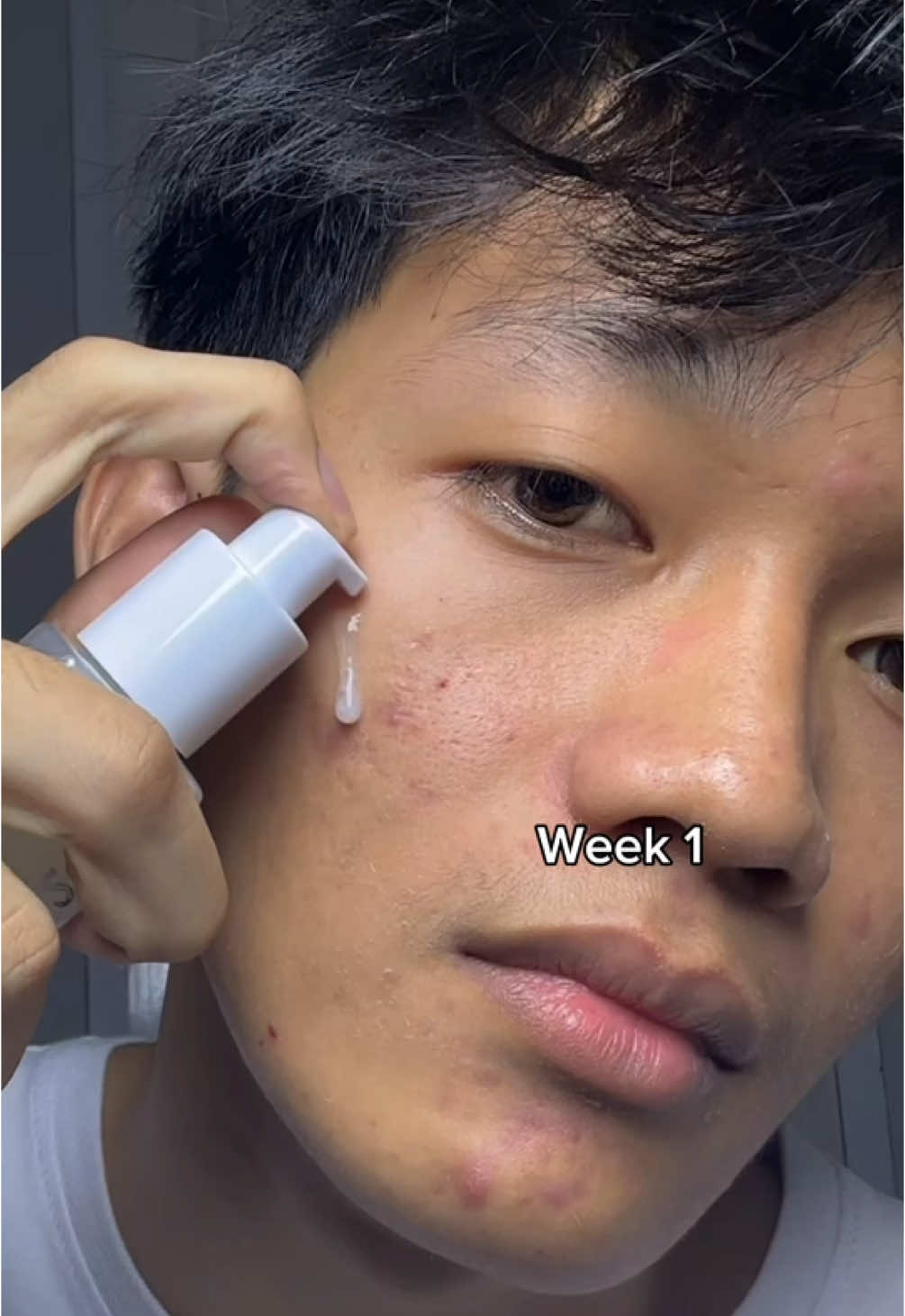 Yaps aku pake serum 377 dari Glad2Glow #serumdarkspot #serumviral #symwhite 