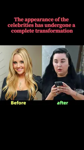 The appearance of the celebrities has undergone a complete transformation，Each one is a pity!#celebrities #hollywood #actors #young #star #usa #us #amandabynes #belahadid 