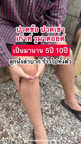 ปวดตามข้อเข่า ร้าวลงขา #บํารุงข้อเข่าเอ็นกระดูเสื่อม #คอลลาเจนมิโอะ #Miocollagen 