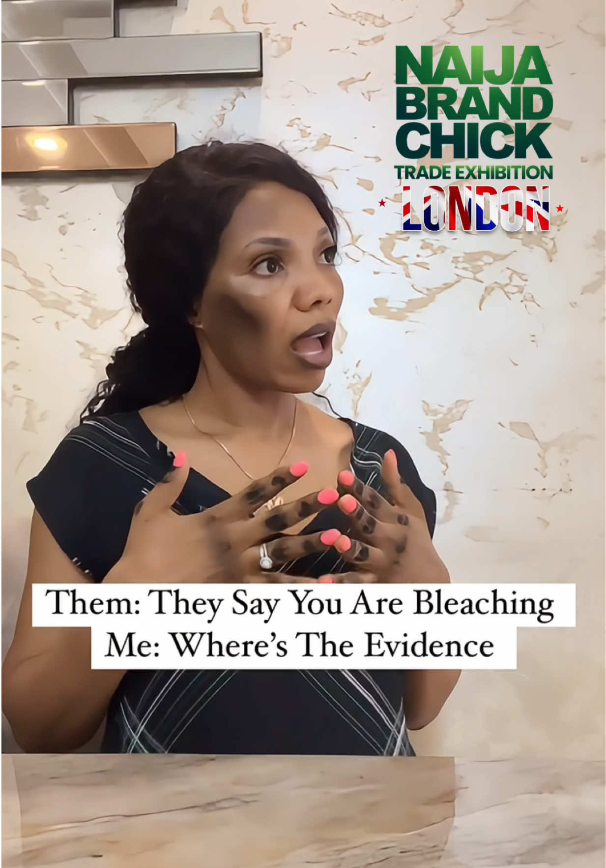 You don’t have to walk around looking like this with damaged, uneven skin. This not the way to glow 🤦🏾‍♀️ In this day and age, there are safe, effective ways to enhance your natural beauty—no harsh chemicals or bleaching needed.  Join us at the NBC Trade Exhibition in London on August 2nd and 3rd, and discover high-quality, effective skincare that works for your skin, not against it. Let’s glow naturally, the right way. Meet us @nbctradeexhibition in: 🇬🇧LONDON:  🗓️ August 2nd & 3rd, 2025  🕚 Time: 11AM Daily  🏢 Venue: Peninsula Ballroom, Intercontinental O2 Hotel,  1 Waterview Drive, London, SE10 0TW #HealthySkin #GlowNaturally #NBCLondon #saynotobleaching #notoharshproducts #naturalskincare #skincarecommunity