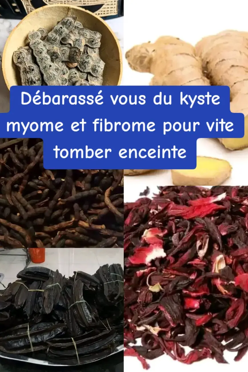 #tomberenceinte #concevoir #grossesse #enceinte #