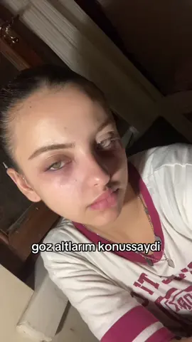 konusmasinlar #fyp #keşfet #keşfetteyizzz #keşfetbenial #foryoupage 