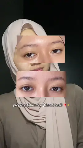 inii progress aku dalam menggunakan serum glowies, akhirnya alis aku gak tipis tipis bgtt 😭 #glowiesbeauty #serumalis #review #skincare #fyp #fyy 
