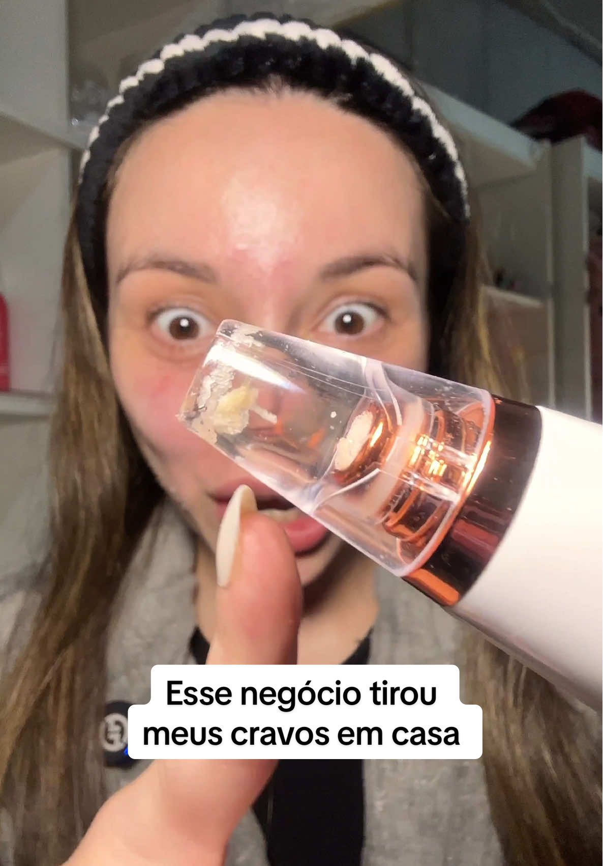 Como eu tirei os cravos e pele morta da minha pele com esse removedor de cravos em casa 😱😱😱 #removedordecravos #tiktokshopchegou #extraircravos #cravolovers #cravos 