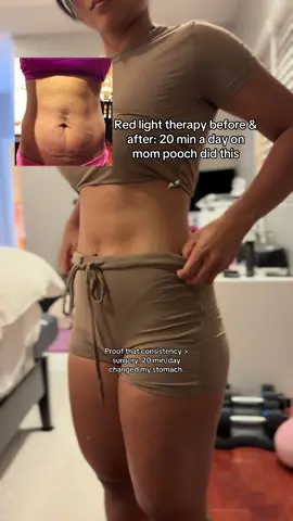 20 minutes a day of red light therapy helped me: ✔ Breaks down fat cells ✔ Boosts collagen + elasticity ✔ Improves scars & stretch marks ✔ Tightens skin without surgery  #redlight #redlighttherapy  #redlighttherapybenefits #bodysculpting #massager #massagerwithheat #SelfCare #selfcareroutine #tiktokshop #TikTokShopCreatorPicks #tiktokshopbacktoschool  #creatorsearchinsights  red led light therapy before and after stomach