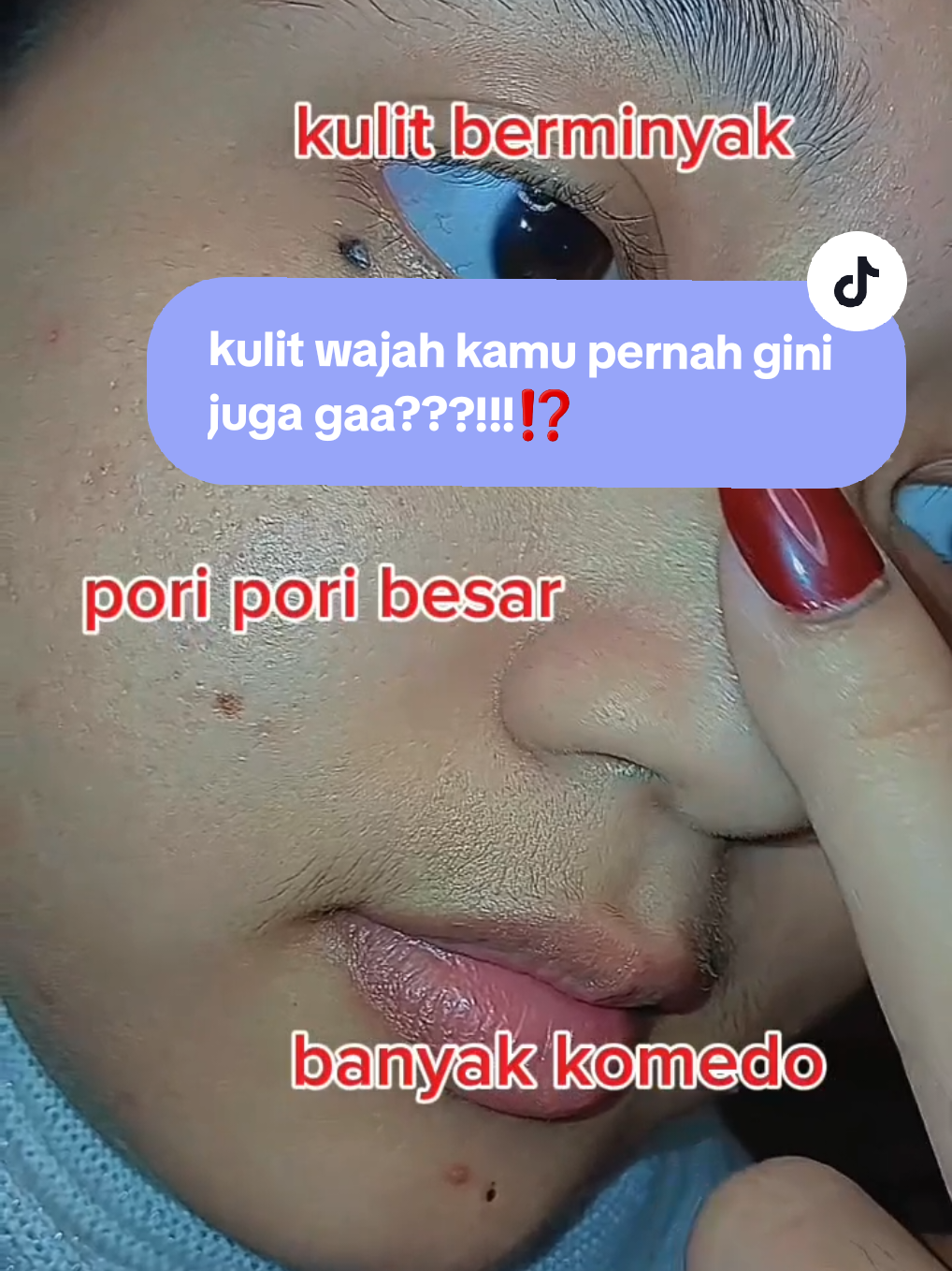 SINI KUMPUL YG PUNYA PERMASALAHAN KULITTT KY GINIII⁉️ #springorgin #pembersihwajah 