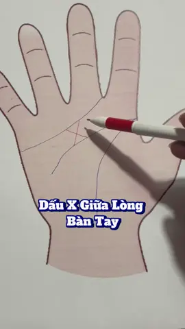 Dấu X Trong Lòng Bàn Tay