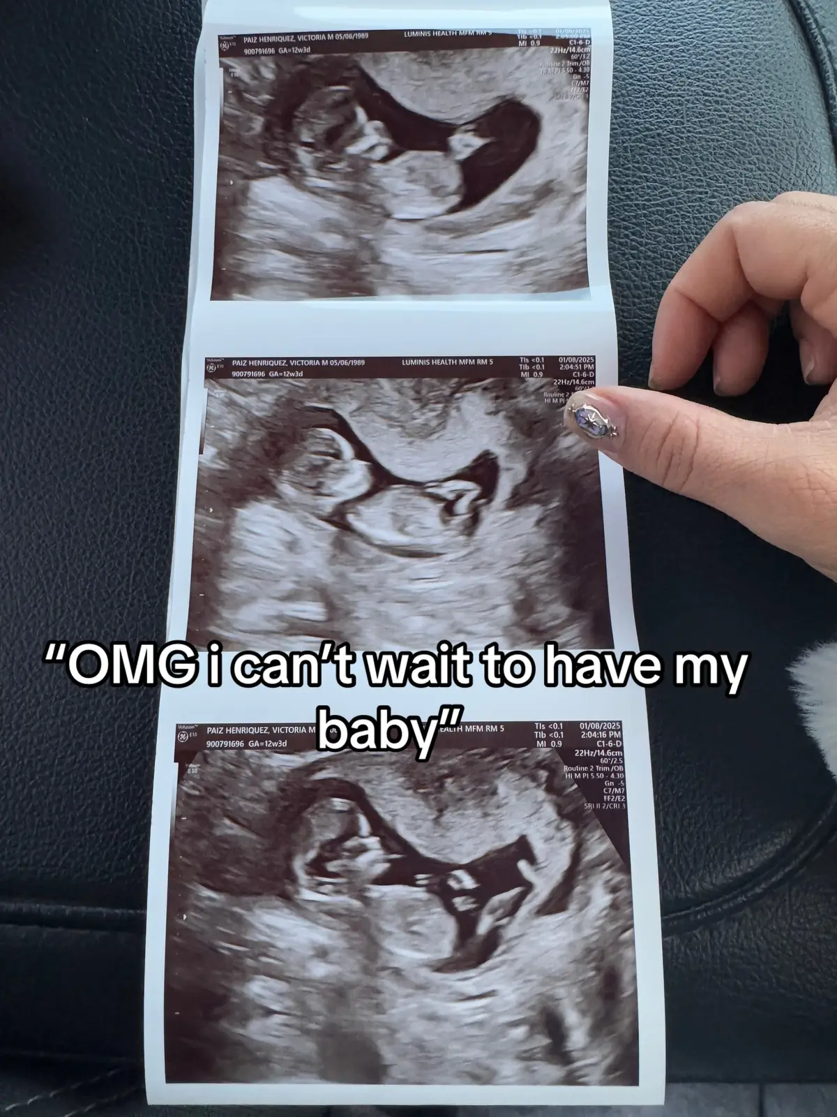 Everything was worth it at the end! 🩵#julybaby #motherhood #MomsofTikTok #foryoupage #summerpregnancy #csectionmom #csectionrecovery 