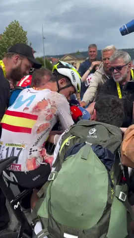 Battered, bruised, but across the line 😳 Ivan Romeo is as tough as they come 💪 #TourDeFrance 