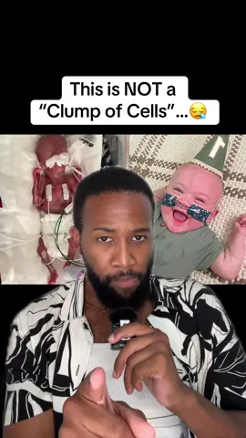 This is NOT a “Clump of Cells”…😪 #america #maga #prolife 