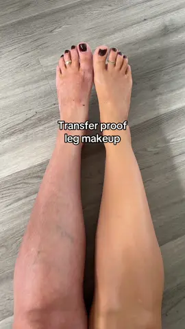#legmakeup #spiderveins #varicoseveins #fyp #viral @YECUCE Beauty Center 