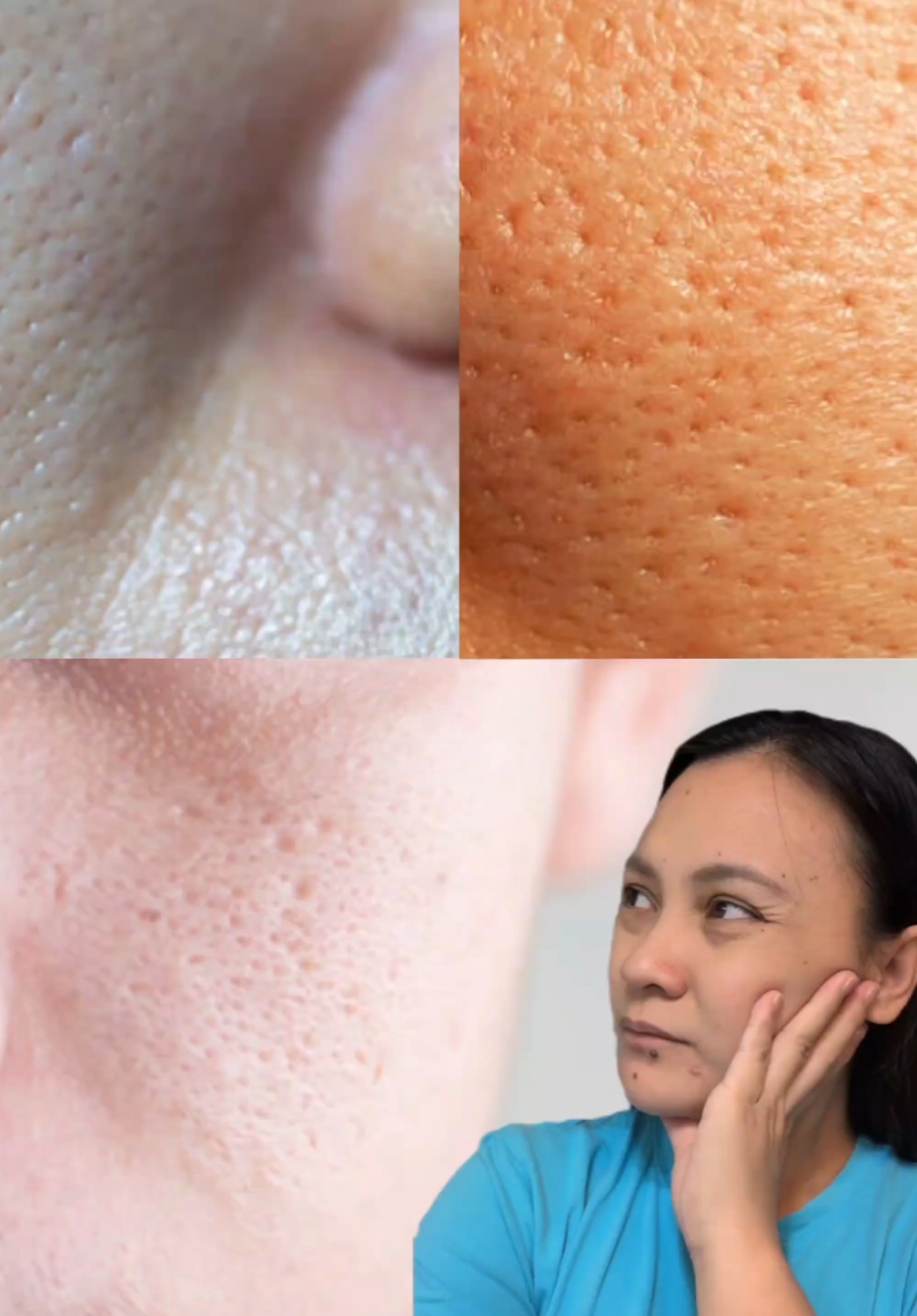 Have you ever iced your face to shrink your pores… just for them to come back the next day? 😩 That’s because cooling is only a temporary fix. This is your real Summer Pore Solution 💙👇 ✨ numbuzin No.3 Blue Bio-Retinol Pore Refining Serum ✔️ Blue Bio-Retinol + Niacinamide = pore care + oil control ✔️ BHA unclogs pores and prevents buildup ✔️ Lightweight, non-greasy texture, perfect for hot, humid weather ✔️ Gentle enough for all skin types, even sensitive ✔️ Safe for daytime use with sunscreen! ☀️ This serum replaced my ice roller. Period. 🙌 AVAILABLE 🛍️👇 numbuzin.com | Amazon | YesStyle(AVERIE888) @numbuzin  #numbuzin #blueretinolserum #retinol #poreserum  #summerskincare  pore care · k-beauty · Korean skincare · skincare routine
