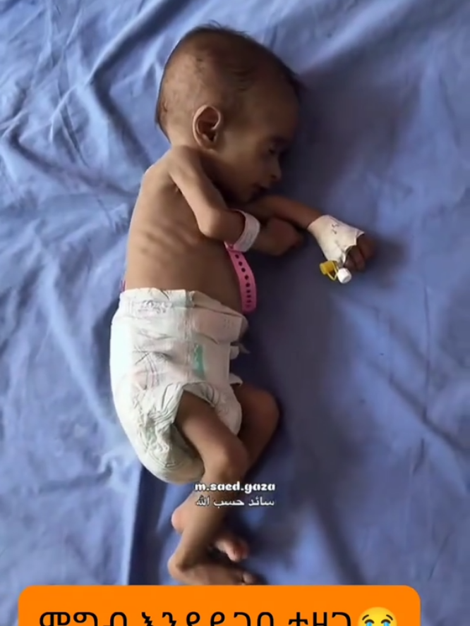 ያአላህ ልባችን ደማ አንተዉ እገዛቸዉ 😭😭😭ያረቢ ዱእ እናርግላቸዉ አቅም ያላቸዉ ሀገራት ነገ እንጠይቃቹሀለን ብለዋል #viral #fyp #foryou  #freepalestine #ፈለስጢን🇸🇩  #oromotiktok #ethiopian_tik_tok🇪🇹🇪🇹🇪🇹🇪🇹  abduking Abdu King ቻግኒ