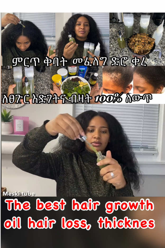 ⭐️ቆንጆ ቅባት ፍለጋ በፍፁም አትዞሩም በጣም ምርጥ ቅባት እንደኔ ስሩ ምስጢር የሆነ ቅባትነው/ Best homemade hair grows secret oil #hair #ethiopian_tik_tok #viral #hairloss #hairgrowthoil #hairgrowth #hairgrowthtips 