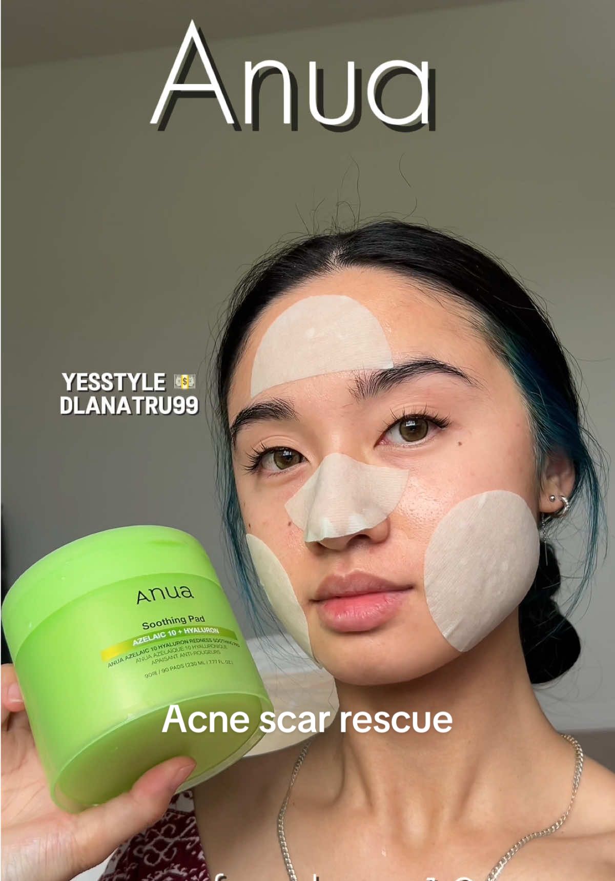 ADULT ACNE RESCUE? @anua_global 💚 💵@YesStyle CODE DLANATRU99💵 This serum is especially designed to support  💚Hormonal and adult acne flare-ups 💚Redness and post-acne scarring 💚Skin barrier recovery and long-term clarity With 10% Azelaic Acid, it’s a gentle yet powerful formula that calms inflammation, smooths texture, and helps restore balance without irritation. Gifted by anua #anua #azelaic #azelaicacid #hormonalacne #adultacne #cycleacne #cleangirlskincare #jawlineacne #acneroutine #skinreset #breakoutrelief #periodacne #acneskincare #skincarethatworks #rednessrelief #sensitiveacne #acnesolution #glassskinroutine #glowyskin #cleangirl #postacneskin #acnescars #skinhealing #kbeautyskincare #acnetips #antiacne #minimalroutine #summeracnecare #oilyskinfix #cloggedpores #anua #kbeauty