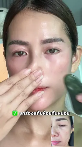 #แอนนี่รีวิว #beauty #กัวซาหน้าเด็ก #กัวซาหน้าใส #กัวซา #นวดหน้าเรียวลดริ้วรอย #นวดหน้า 