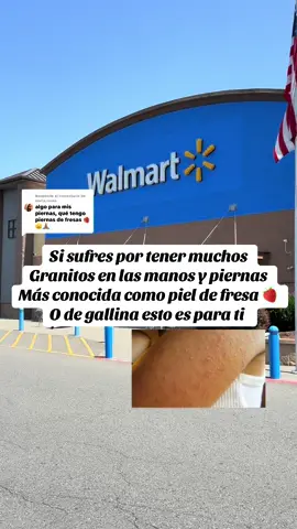 Respuesta a @maria,rosas si sufres por tener granitos en las manos y piernas más conocida como piel de fresa o de gallina esto es para ti 👌🏻 #walmart #walmartfinds #walmarthaul #cremaparapiel@Walmart 