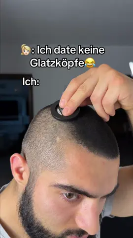 Ich muss mich niewieder für meine Glatze schämen… #hairloss #haare #trending #glatze #fyp #haarausfall #haarentfernung 