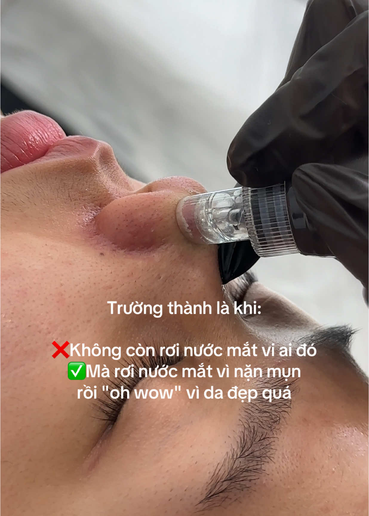 Yêu thương bản thân không bao giờ là sai  #AlohaBeauty #AlohaThaoDien #AlohaSpa #xuhuongtiktok #xuhuong #chamdakhoahoc #fyp #videoviral #FacialCare #SkinDetox #peel #viraltiktok #viralvideo #viral #fypシ #xh #LuxurySpa #mesotherapy #detox 