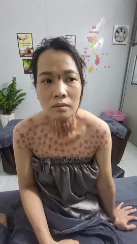 ngõ 26. xóm vang, đông anh, Hà Nội. liên hệ: 0328382798. chuyên nặn gió, giác hơi, cắt lể.