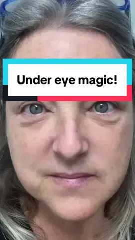 Tomorrow is the last day to get the deal on the new Peter Thomas Roth instant FirmX under eye tightener!! This stuff is amazing!!! #ptrnewarrivals #firmXeyemadeeasy #undereye #undereyebags #undereyewrinkles #maturebeauty @Peter Thomas Roth Labs 