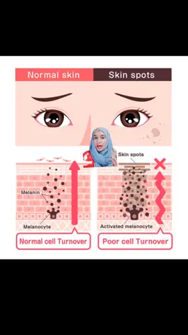 skincare appointment k lye Instagram hoor_skincare_beauty pr inbox kry #skincare #fyp #unfreezemyacount #skincare #pigmentation #darkspots #melasma #lisa  @LaRochePosayUS @Sesderma 