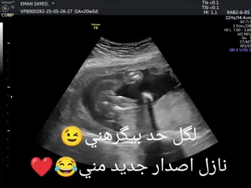 لگل الي مقهور مني التحديث الجديد قرب خلاص😂😘❤️ #CapCut 