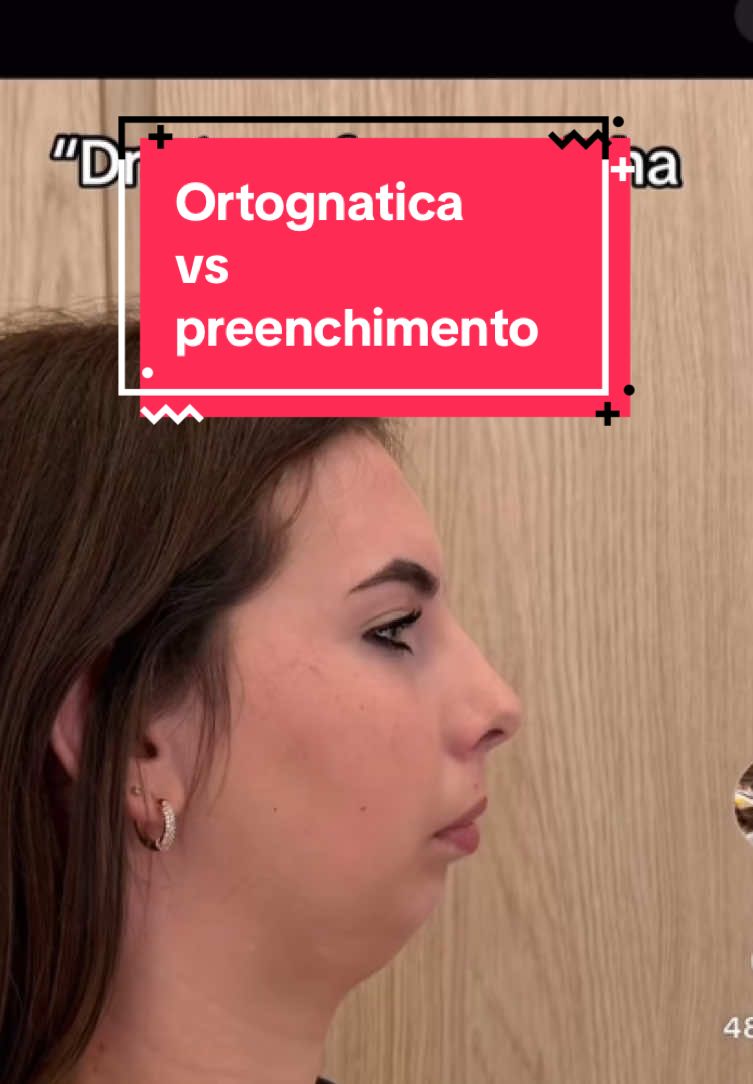 Por que você não deve substituir sua ortognatica #fypシ #looksmaxingbr 