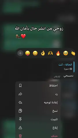 (حاله) يمكن بس اني هيج 🦦😒🌝🙃 عود ردت اخلي يغار يغار 😂😂😂😂😂#الشعب_الصيني_ماله_حل😂😂 #صور #حاله #نشر #زوجي #بامان_الله #مالي_خلق_احط_هاشتاقات 